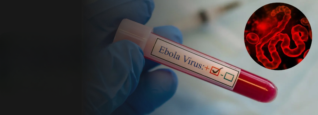 Virus Ebola